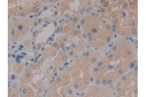 Detection of RNPEP in Human Kidney Tissue using Polyclonal Antibody to Aminopeptidase B (RNPEP)