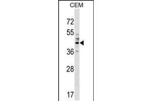 Western blot analysis in CEM cell line lysates (35ug/lane). (CEACAM6 抗体  (AA 188-214))
