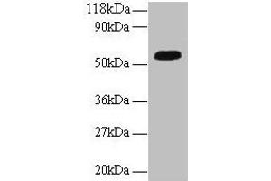 Western blot All lanes: ICA1 antibody at 2 μg/mL + A549 whole cell lysate Secondary Goat polyclonal to rabbit IgG at 1/10000 dilution Predicted band size: 55, 58 kDa Observed band size: 55 kDa (ICA1 抗体  (AA 1-268))