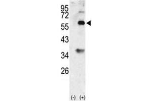 Western blot analysis of BMP3 antibody and 293 cell lysate (2 ug/lane) either nontransfected (Lane 1) or transiently transfected with the BMP3 gene (2). (BMP3 抗体  (AA 8-36))