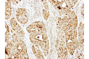 IHC-P Image Immunohistochemical analysis of paraffin-embedded NCI-N87 xenograft, using BBS10, antibody at 1:500 dilution. (BBS10 抗体)