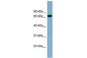 WB Suggested Anti-SNAG1 Antibody Titration: 0. (SNX18 抗体  (N-Term))