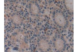 IHC-P analysis of Human Stomach Tissue, with DAB staining. (VPREB1 抗体  (AA 33-135))