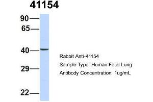 Host: Rabbit  Target Name: 41154  Sample Tissue: Human Fetal Lung  Antibody Dilution: 1. (Septin 2 抗体  (N-Term))