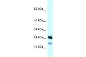 Image no. 1 for anti-NADH Dehydrogenase (Ubiquinone) 1 beta Subcomplex, 10, 22kDa (NDUFB10) (C-Term) antibody (ABIN6747916) (NDUFB10 抗体  (C-Term))
