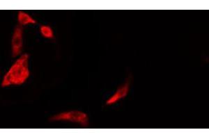 ABIN6274387 staining Hela cells by IF/ICC. (DAK 抗体  (Internal Region))