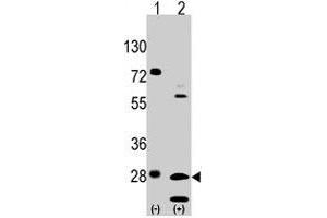 Western blot analysis of GRB2 (arrow) using rabbit GRB2 polyclonal antibody . (GRB2 抗体  (Tyr209))