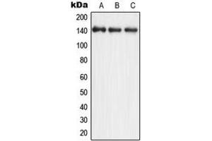 Western blot analysis of eNOS expression in A549 (A), HuvEc (B), rat brain (C) whole cell lysates. (ENOS 抗体  (Center))