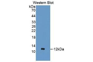 Western blot analysis of the recombinant protein. (Aggrecan 抗体  (AA 587-684))