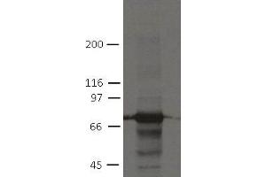 Image no. 1 for anti-Plakophilin 1 (PKP1) (AA 235-726) antibody (ABIN1169699) (Plakophilin 1 抗体  (AA 235-726))