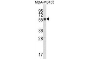 Western Blotting (WB) image for anti-Spermatogenesis and Oogenesis Specific Basic Helix-Loop-Helix 2 (SOHLH2) antibody (ABIN3000290) (SOHLH2 抗体)