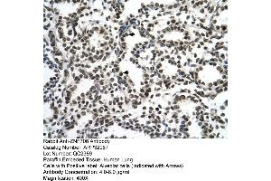 Human Lung (ZNF706 抗体  (N-Term))