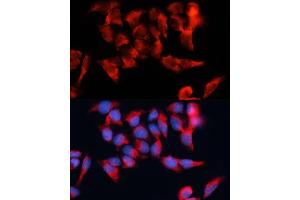 Immunofluorescence analysis of HeLa cells using BST2 antibody (ABIN6129547, ABIN6137673, ABIN6137675 and ABIN6215924) at dilution of 1:100.