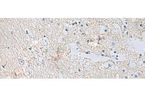Immunohistochemistry (Paraffin-embedded Sections) (IHC (p)) image for anti-Retinol Dehydrogenase 5 (11-Cis/9-Cis) (RDH5) antibody (ABIN7254061)
