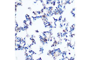 Immunohistochemistry of paraffin-embedded Rat lung using PKM2 Rabbit pAb (ABIN6128296, ABIN6145714, ABIN6145715 and ABIN6218076) at dilution of 1:100 (40x lens).