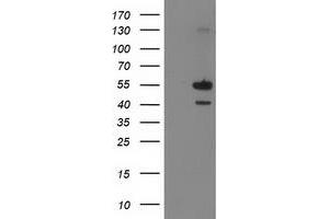 Image no. 1 for anti-Phosphatidylinositol-5-Phosphate 4-Kinase, Type II, alpha (PIP4K2A) antibody (ABIN1500226) (PIP4K2A 抗体)