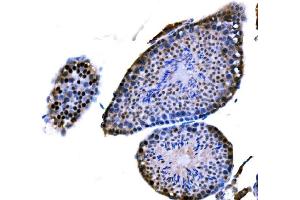 IHC analysis of DMC1 using anti-DMC1 antibody (ABIN7601468).