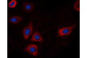 Immunofluorescent analysis of EGFR (pT693) staining in HEK293T cells. (EGFR 抗体  (pSer693))