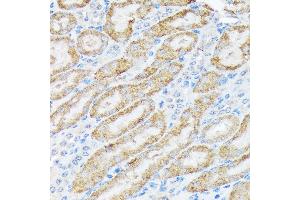 Immunohistochemistry of paraffin-embedded mouse kidney using TIRAP Rabbit mAb (ABIN7270842) at dilution of 1:100 (40x lens). (TIRAP 抗体)