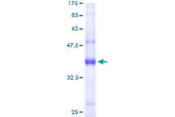 AP2S1 Protein (AA 1-142) (GST tag)