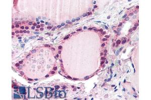ABIN185700 (5µg/ml) staining of paraffin embedded Human Thyroid.