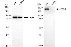 Western blotting analysis using PASK antibody (ABIN7799741). (PASK 抗体)