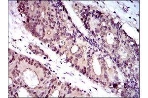 Immunohistochemistry (IHC) image for anti-Wolf-Hirschhorn Syndrome Candidate 2 (WHSC2) (AA 280-511) antibody (ABIN1724801)