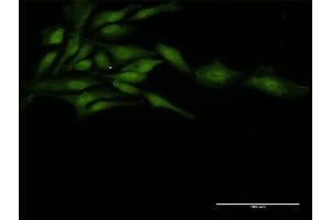 Immunofluorescence of purified MaxPab antibody to ZFP36 on HeLa cell. (ZFP36 抗体  (AA 1-326))