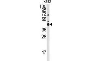 Western Blotting (WB) image for anti-BCL2-Like 14 (Apoptosis Facilitator) (BCL2L14) (BH3 Domain) antibody (ABIN2997105) (BCL2L14 抗体  (BH3 Domain))
