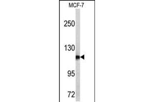 Western blot analysis of PSA antibody in MCF-7 cell line lysates (35ug/lane) (Prostate Specific Antigen 抗体  (C-Term))