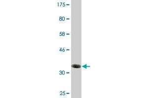 Western Blot detection against Immunogen (35. (BAALC 抗体  (AA 61-145))
