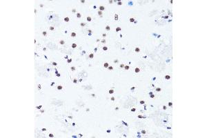 Immunohistochemistry of paraffin-embedded mouse brain using Symmetric DiMethyl-Histone H3-R2 antibody (ABIN3016053, ABIN3016054, ABIN3016055, ABIN1680220 and ABIN6219534) at dilution of 1:100 (40x lens).