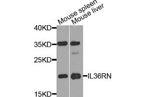 Western blot analysis of extract of mouse spleen and mouse liver cells, using IL36RN antibody. (FIL1d 抗体)