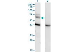 Western Blot analysis of MAP3K7 expression in transfected 293T cell line by MAP3K7 monoclonal antibody (M04), clone 3C9.