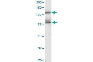 CDH11 monoclonal antibody (M04), clone 1A5. (OB Cadherin 抗体  (AA 54-612))