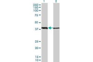 Western Blot analysis of ZNF187 expression in transfected 293T cell line by ZNF187 monoclonal antibody (M01A), clone 1D9. (ZNF187 抗体  (AA 1-325))