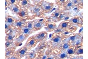 Detection of FTH in Rat Liver Tissue using Polyclonal Antibody to Ferritin, Heavy Polypeptide (FTH) (FTH1 抗体)