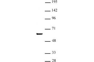 SETD7 / SET7 (pAb) tested by Western blot. (SETD7 抗体)
