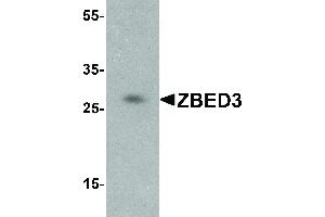 Western Blot of ZBED3 Antibody - Western Blot of ZBED3 antibody. (ZBED3 抗体  (C-Term))