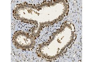 IHC analysis of FOXP1 using anti-FOXP1 antibody (ABIN7602780). (FOXP1 抗体  (C-Term))