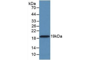 Detection of Recombinant CYPA, Human using Monoclonal Antibody to Cyclophilin A (CYPA) (PPIA 抗体  (AA 2-165))