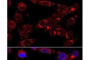 Immunofluorescence analysis of HeLa cells using GM130 Polyclonal Antibody at dilution of 1:400 (60x lens). (Golgin A2 (GOLGA2) 抗体)