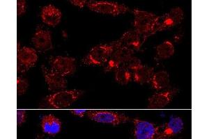 Immunofluorescence analysis of HeLa cells using GM130 Polyclonal Antibody at dilution of 1:400 (60x lens). (Golgin A2 (GOLGA2) 抗体)