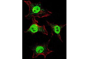 Fluorescent confocal image of HeLa cells stained with ITGA6 (isoform 2 ) antibody. (ITGA6 抗体  (Isoform 2))