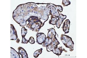 IHC analysis of TMPRSS13 using anti-TMPRSS13 antibody (ABIN7599797).