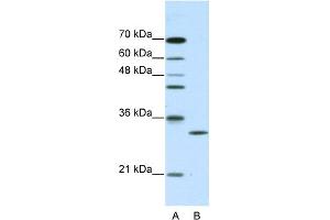 CLIC1 antibody - C-terminal region  validated by WB using purified recombinant CLIC1 protein and transfected lysate (CLIC1 抗体  (C-Term))