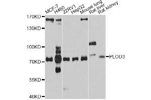 Western blot analysis of extracts of various cell lines, using PLOD3 antibody. (PLOD3 抗体)