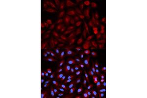 Immunofluorescence analysis of HeLa cell using PSME3 antibody. (PSME3 抗体  (AA 1-254))