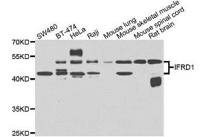 Western blot analysis of extracts of various cell lines, using IFRD1 antibody. (IFRD1 抗体)