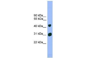 WB Suggested Anti-Lhx5 Antibody Titration: 0. (LHX5 抗体  (Middle Region))